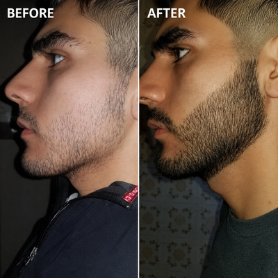 Elevra Facial Hair Serum